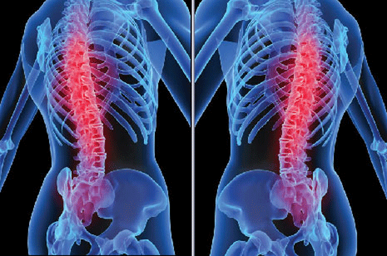 Bel Soğukluğu Nasıl Bulaşır